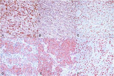 H2AFZ: A Novel Prognostic Marker in Canine Melanoma and a Predictive Marker for Resistance to CDK4/6 Inhibitor Treatment